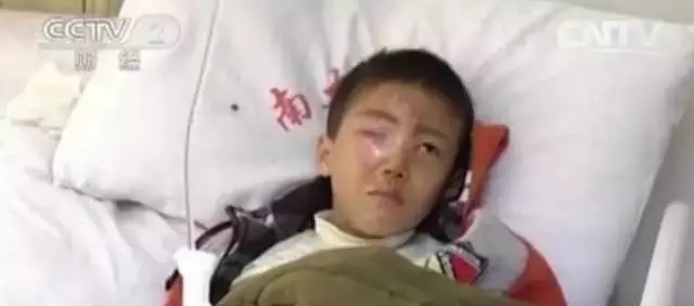 短短20分钟孩子眼珠被溶解！这东西大驻马家家都有，千万要当心！