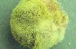 它的毒性是砒霜的68倍，开水煮不死，现在就在你家厨房！