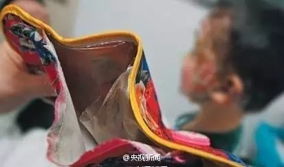 驻马店家家都有的这东西，竟是定时炸弹！已有人严重烧伤！赶紧扔掉！