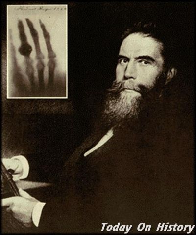 什么是伦琴射线 伦琴发现X射线的故事--驻马店