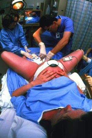 实拍:女性妇科检查全程(组图)