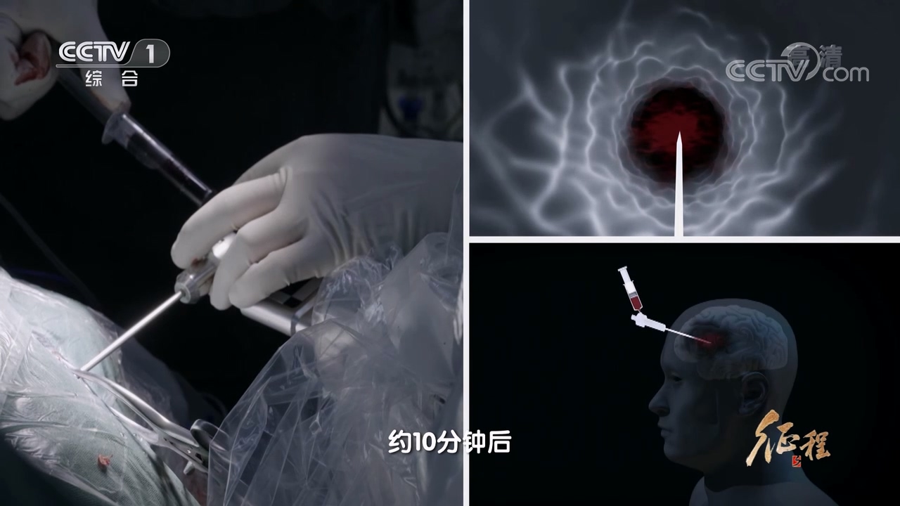 大型纪录片《征程》｜第十一集 生命的承诺