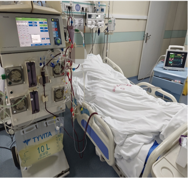 重症医学科联合血液净化科成功救治肾衰合并心衰患者  床旁连续血液净化治疗显威力，危急时刻守护生命