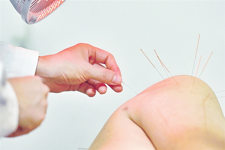 针灸调理 重在得气