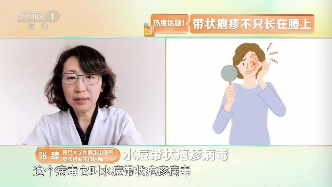 50岁以上高发 带状疱疹如何科学预防？