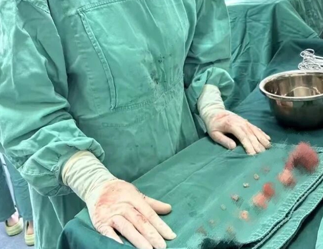 15颗肌瘤，毫米级“排雷”——驻马店市中医院为患者圆健康梦