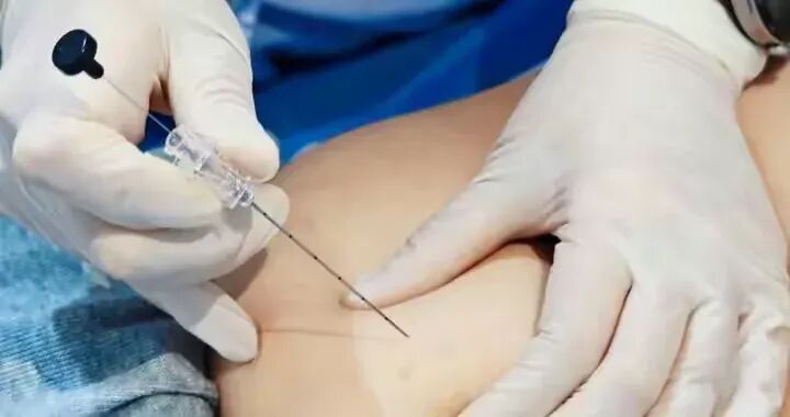 早春二月“轻身”正当时 驻马店市中医院推出中医穴位埋线减肥法