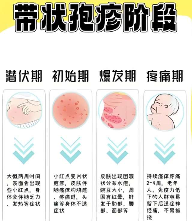  带状疱疹进入高发期 专家提醒：预防胜于治疗，接种疫苗最有效